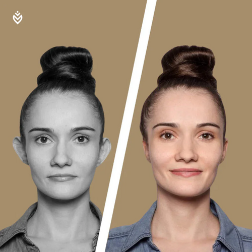 Ear Corrector